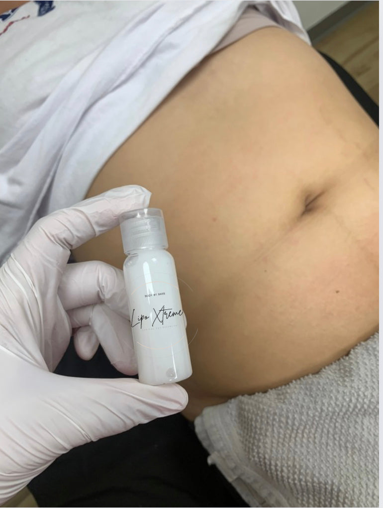 Lipo Xtreme Fat Dissolve